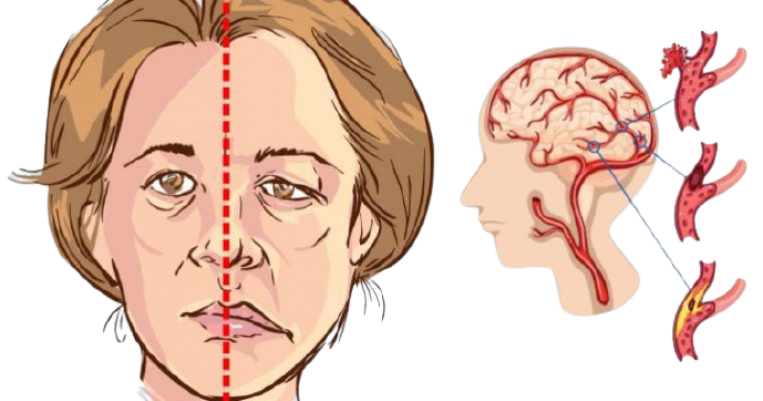 velavan health issue image